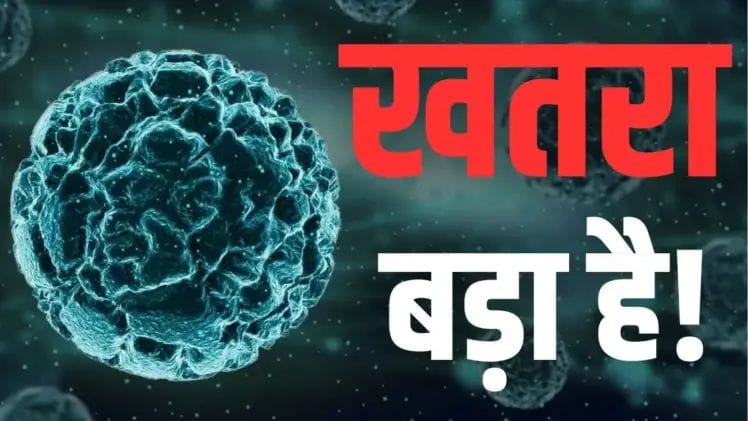 More than 50 cases of Chandipura virus found in Gujarat, take special care of children up to 15 years of age