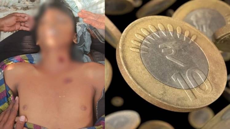 10 rupee coin proved fatal, boy was making a gun after watching YouTube, then something happened that he lost his life