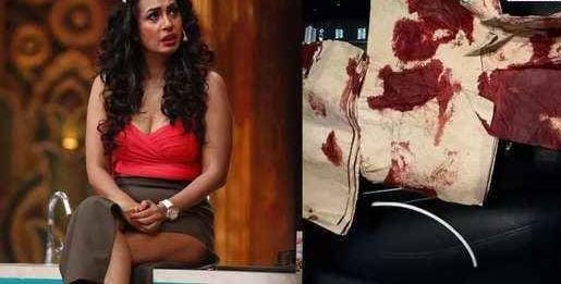 Actress Kashmira Shah had a terrible accident, narrowly escaped death