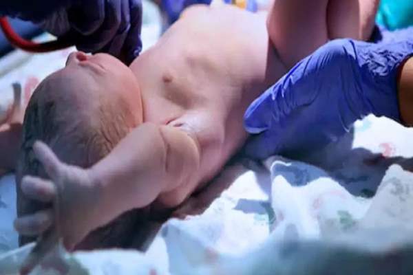 omg-baby’s-birth-shocks-doctors-separated-from-mother-immediately