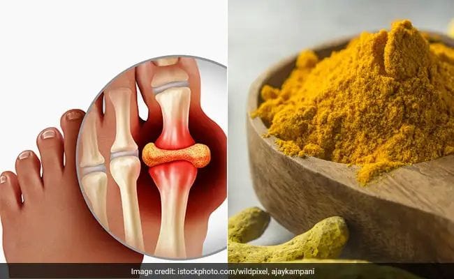 Want to control uric acid naturally? Make these 4 yellow foods a part of your diet